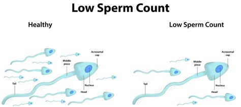 Low sperm count .